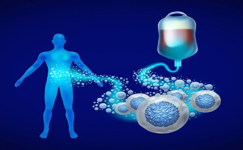 牙髓来源干细胞治疗银屑病的研究进展