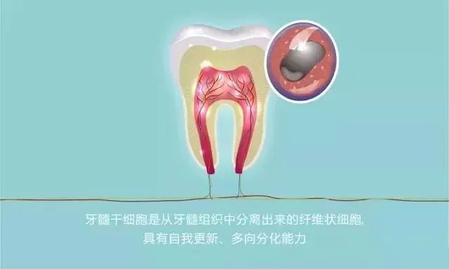 乳牙中的“宝藏”——牙髓干细胞